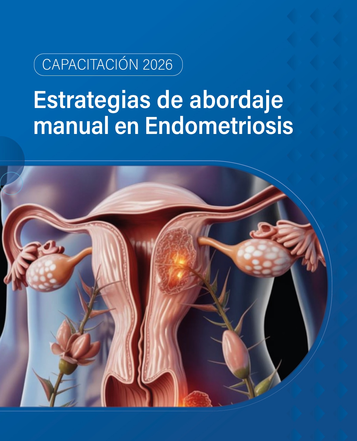 ESTRATEGIAS DE ABORDAJE MANUAL EN ENDOMETRIOSIS