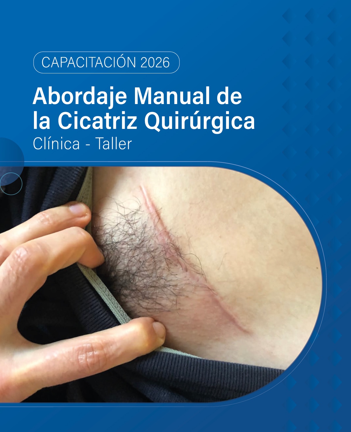 ABORDAJE MANUAL DE LA CICATRIZ QUIRÚRGICA